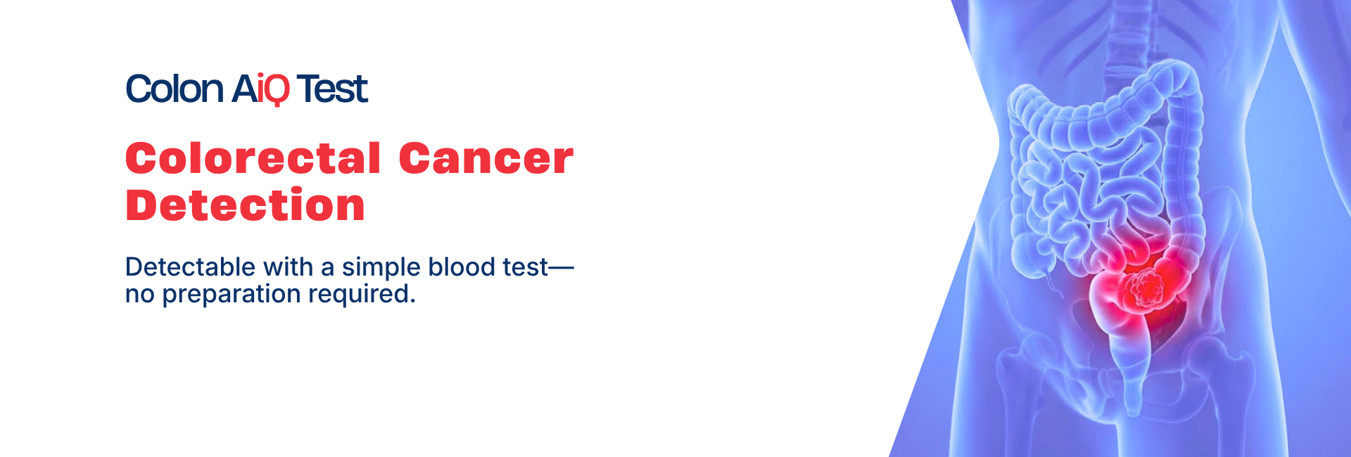 Colon AiQ Molecular Blood Test for Colorectal Cancer | Falireas Medical
