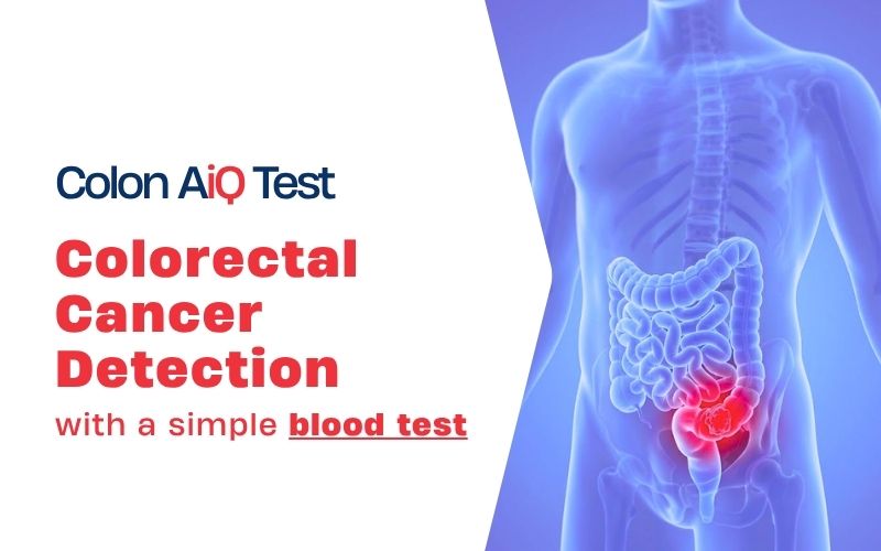 Colon AiQ Molecular Blood Test for Colorectal Cancer | Falireas Medical